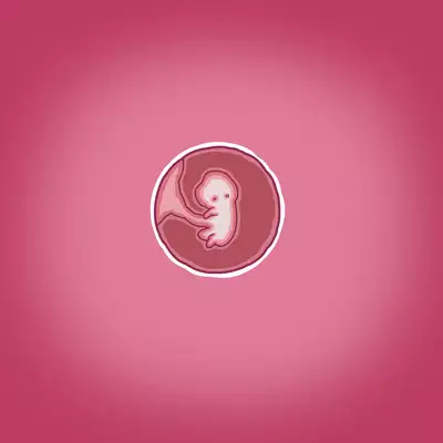 Yumi's Study Abroad/由美的留学生活（汉化）（连载中）