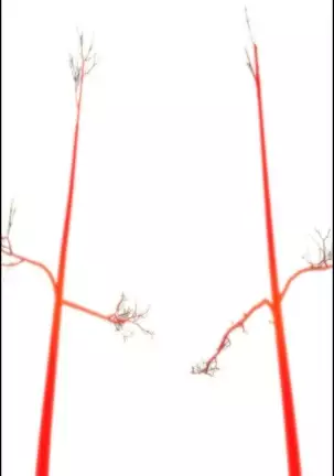 Lilith`s Cord Ch.0-43